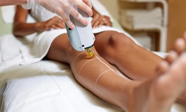Laser hair removal training